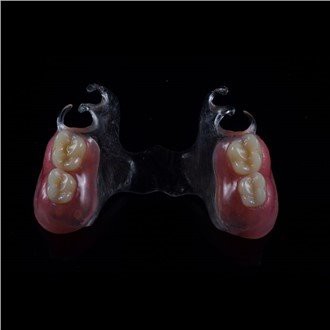 Odnímateľná akrylová čiastočná zubná protéza