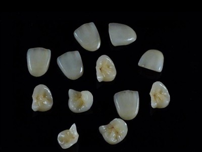 Ako si vybrať najlepšie dentálne lepidlo na korunky: Najnovší sprievodca