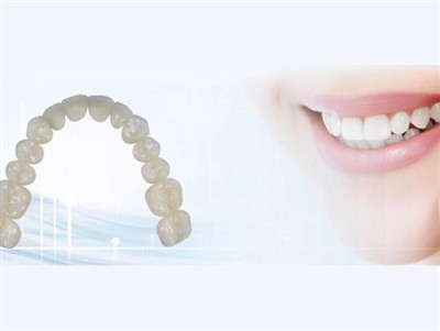 Outsourcing zubných laboratórií: Výhody, nevýhody a kľúčové úvahy