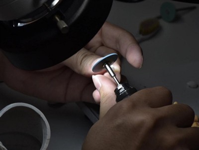 Ako dlho vydržia korunky PFM? Priemerná životnosť, faktory a tipy na starostl...