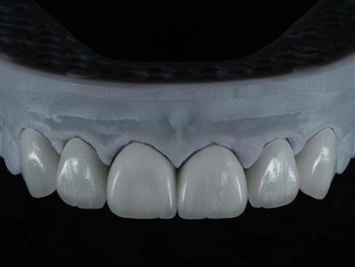 Ako outsourcovať prácu zubného laboratória v zahraničí: komplexný sprievodca